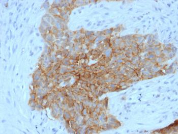 Anti-GLUT-1 (Tumor Progression and Mesothelioma Marker) Monoclonal Antibody(Clone: GLUT1/2475)