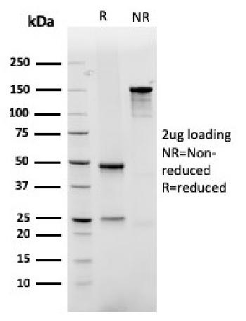 Anti-GLUT-1 (Tumor Progression and Mesothelioma Marker) Monoclonal Antibody(Clone: rGLUT1/2476)