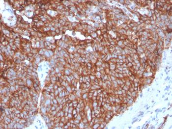 Anti-GLUT-1 (Tumor Progression and Mesothelioma Marker) Monoclonal Antibody(Clone: GLUT1/3132R)