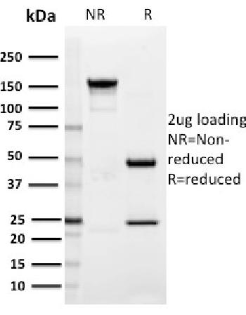 Anti-SIGLEC1 / CD169 / Sialoadhesin Monoclonal Antibody(Clone: HSn 7D2)