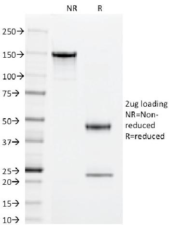 Anti-Superoxide Dismutase 1 (SOD1) (Antioxidant Enzyme) Monoclonal Antibody(Clone: SOD1/2089)