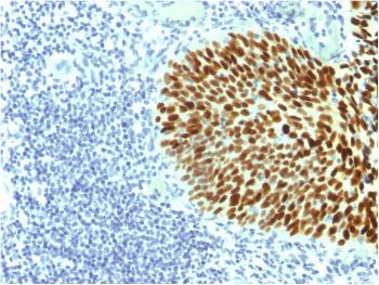 Anti-SOX2 (Embryonic Stem CellMarker) Monoclonal Antibody(Clone: SOX2/1791)