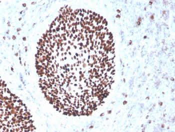 Anti-SOX2 (Embryonic Stem Cell Marker) Monoclonal Antibody(Clone: rSOX2/1791)