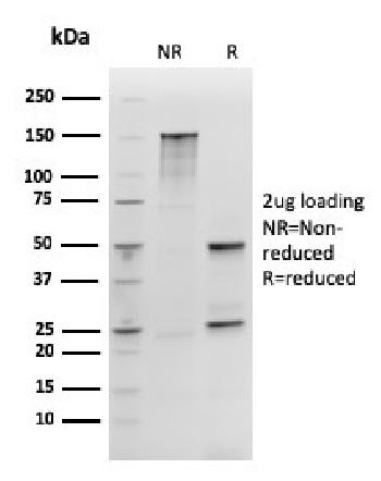 Anti-SOX2 (Embryonic Stem Cell Marker) Monoclonal Antibody(Clone: rSOX2/1792)