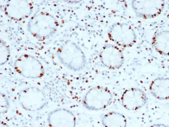 Anti-SOX4 (Master Regulator of Epithelial-Mesenchymal Transition) Monoclonal Antibody(Clone: SOX4/2540)