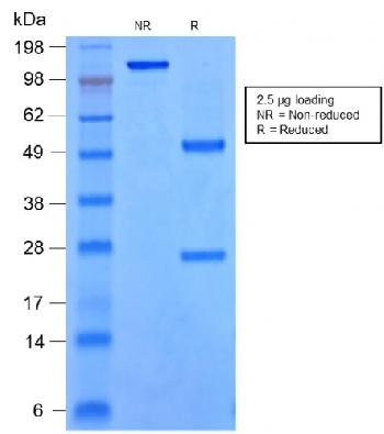 Anti-SOX9 / SRY-box 9 Monoclonal Antibody(Clone: rSOX9/2288)(Discontinued)