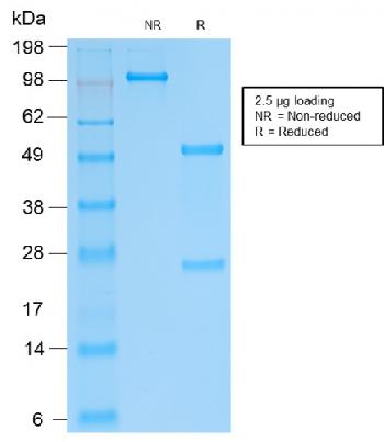 Anti-SOX9 / SRY-box 9 Monoclonal Antibody(Clone: SOX9/2287R)