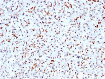 Anti-SOX9 / SRY-box 9 Monoclonal Antibody(Clone: SOX9/3141R)