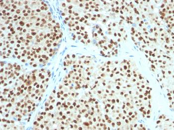 Anti-SOX10 (Melanoma Marker) Monoclonal Antibody(Clone: SOX10/991)