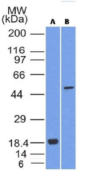 Anti-SOX10 (Melanoma Marker) Monoclonal Antibody(Clone: SOX10/992)