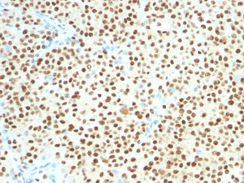 Anti-SOX10 (Melanoma Marker) Monoclonal Antibody(Clone: SOX10/1074)