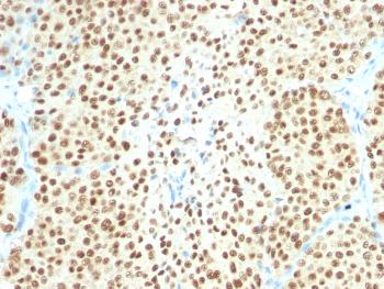 Anti-SOX10 (Melanoma Marker) Monoclonal Antibody(Clone: SPM607)