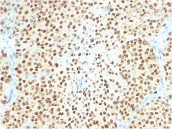 Anti-SOX10 (Melanoma Marker) Monoclonal Antibody(Clone: SOX10/2311R)