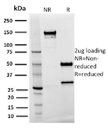 Anti-Spastin Monoclonal Antibody(Clone: Sp 3G11-1)