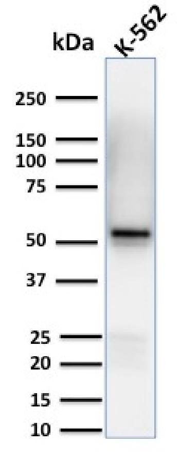 Anti-Spastin Monoclonal Antibody(Clone: Sp 6C6)