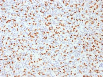 Anti-PU.1 (SPI-1) (B-Cell Marker) Monoclonal Antibody(Clone: PU1/2146)