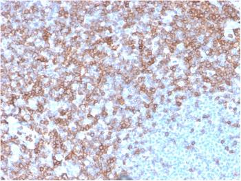 Anti-CD43 (T-Cell Marker) Monoclonal Antibody(Clone: SPN/3388)