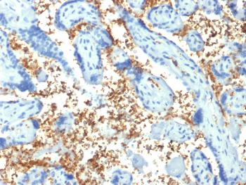 Anti-Spectrin Alpha 1 (Erythrocyte Marker) Monoclonal Antibody(Clone: SPTA1/1810)