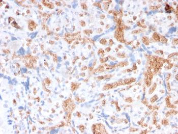 Anti-Spectrin Alpha 1 (Erythrocyte Marker) Monoclonal Antibody(Clone: rSPTA1/1832)