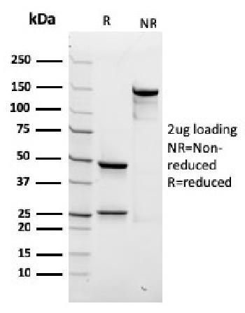 Anti-Spectrin beta III (SPTBN2) Monoclonal Antibody(Clone: rSPTBN2/1778)