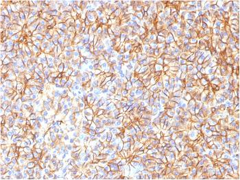 Anti-Spectrin beta III (SPTBN2) Monoclonal Antibody(Clone: SPTBN2/1584)