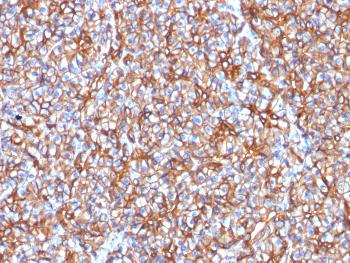 Anti-Spectrin beta III (SPTBN2) Monoclonal Antibody(Clone: SPTBN2/1778)