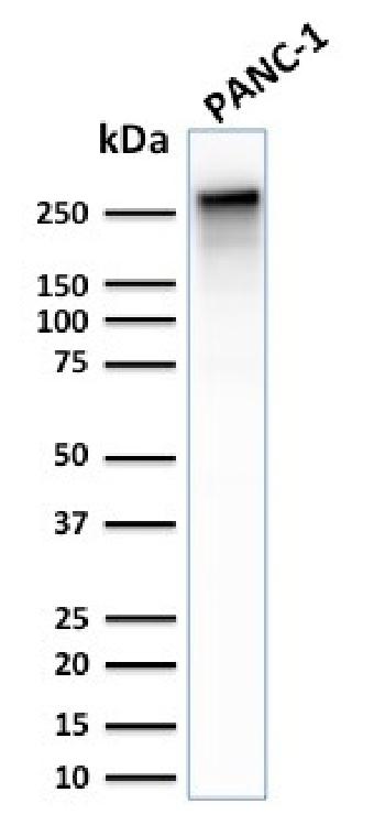 Anti-Spectrin beta III (SPTBN2) Monoclonal Antibody(Clone: SPTBN2/2887R)