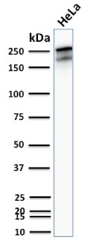 Anti-Spectrin beta III (SPTBN2) Monoclonal Antibody(Clone: SPTBN2/2894R)