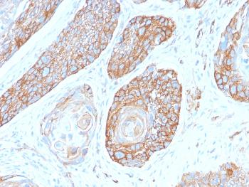 Anti-Spectrin beta III (SPTBN2) Monoclonal Antibody(Clone: SPTBN2/2979R)