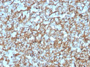 Anti-Spectrin beta III (SPTBN2) Monoclonal Antibody(Clone: SPTBN2/3142R)