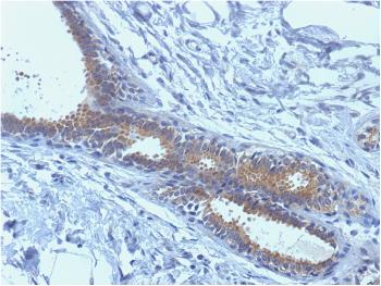 Anti-BRCA1 (Breast Marker) Monoclonal Antibody(Clone: BRCA1/1398)