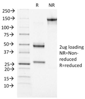 Anti-BRCA1 (Breast Marker) Monoclonal Antibody(Clone: BRCA1/1472)