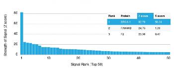 Anti-BRCA1 (Breast Marker) Monoclonal Antibody(Clone: BRCA1/2986)