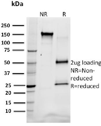 Anti-SREBP1 Monoclonal Antibody(Clone: SREBP1/1578)