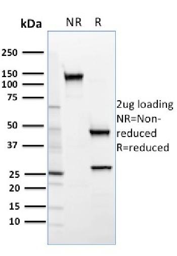 Anti-SREBP2 Monoclonal Antibody(Clone: SREBP2/1579)