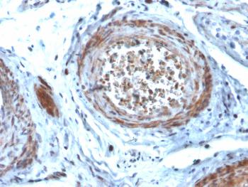 Anti-StAR (Steroidogenic Acute Regulator) (Leydig Cell Marker) Monoclonal Antibody(Clone: STAR/2077)