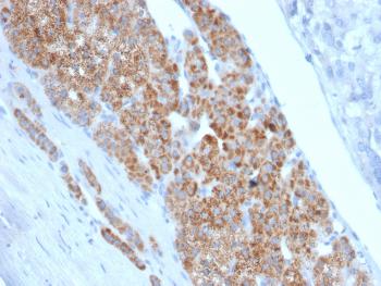 Anti-StAR (Steroidogenic Acute Regulator) (Leydig Cell Marker) Monoclonal Antibody(Clone: STAR/2140)