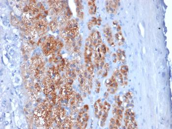 Anti-StAR (Steroidogenic Acute Regulator) (Leydig Cell Marker) Monoclonal Antibody(Clone: STAR/2154)