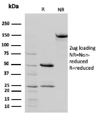 Anti-STAT5B Monoclonal Antibody(Clone: STAT5B/2657)