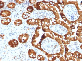 Anti-Sulfotransferase family 1E, estrogen-preferring, member 1 Monoclonal Antibody(Clone: CPTC-SULT1E1-1)