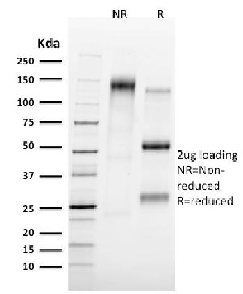 Anti-Tal1 Monoclonal Antibody(Clone: TAL1/2707)