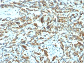 Anti-pS2 / pNR-2 / TFF1 (Estrogen-Regulated Protein) Monoclonal Antibody(Clone: TFF1/2133)