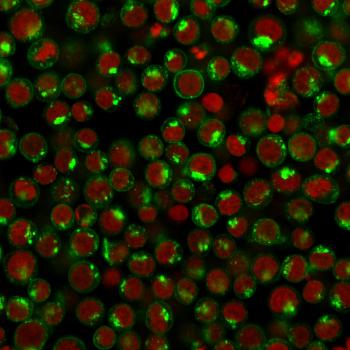 Anti-CD71 / Transferrin Receptor (TFRC) Monoclonal Antibody(Clone: DF1513)