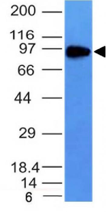 Anti-CD71 / Transferrin Receptor (TFRC) Monoclonal Antibody(Clone: TFRC/1149)