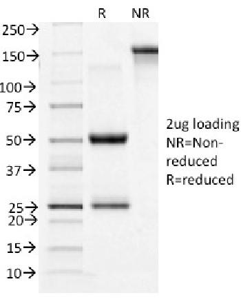 Anti-CD71 / Transferrin Receptor (TFRC) Monoclonal Antibody(Clone: TFRC/1396)