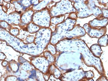 Anti-CD71 / Transferrin Receptor (TFRC) (Extracellular Domain) Monoclonal Antibody(Clone: TFRC/1818)