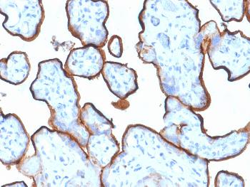 Anti-CD71 / Transferrin Receptor (TFRC) (Extracellular Domain) Monoclonal Antibody(Clone: TFRC/1839)