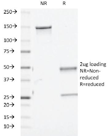 Anti-TGF-beta (Transforming Growth Factor beta) Monoclonal Antibody(Clone: TGFB/510)