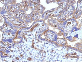 Anti-Thrombomodulin / CD141 (Endothelial Cell Marker) Monoclonal Antibody(Clone: THBD/1782)