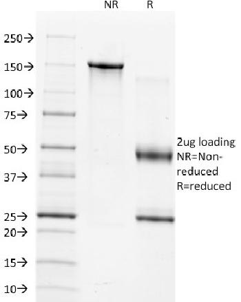 Anti-TIMP1 (Marker of Lymph Node Metastasis) Monoclonal Antibody(Clone: 2A5)